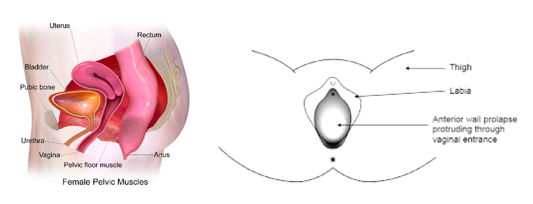 Diagram of the female pelvic muscles