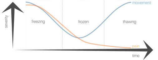 Stages of Frozen Shoulder